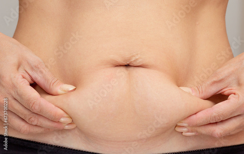 Hands on belly pressed skin to show sagging skin after diet and stretch marks after pregnancy over gray background photo