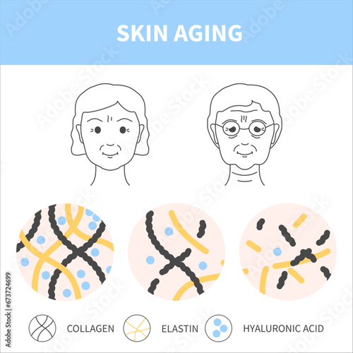 Skin aging process showing reduction of collagen, elastin and hyaluronic acid cells with age. Skin changes in younger and older woman. Beauty and wellness concept. Medical vector illustration.
