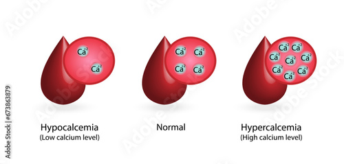 Hypercalcemia, high plasma calcium level and hypocalcemia, low plasma calcium level. Calcium excess and deficit electrolyte disorders, blood droplet, Scientific design. Vector illustration.