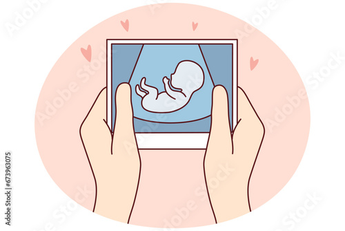 Hands of person holding scan of embryo waiting for baby birth. Future mother with ultrasound picture of baby. Motherhood concept. Vector illustration.