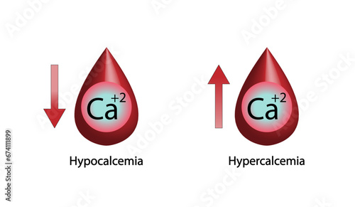 Hypocalcemia, low plasma calcium level. Calcium excess and deficit electrolyte disorders, blood droplet, Scientific design. Vector illustration.	
