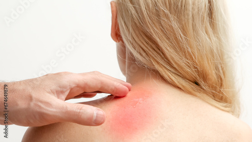 Man applying pain relieving cream, gel on woman's neck on white background. Pain relief and health care concept. photo