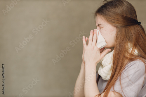 Young woman blowing nose has winter flu catarrh ill sick disease treatment cold photo