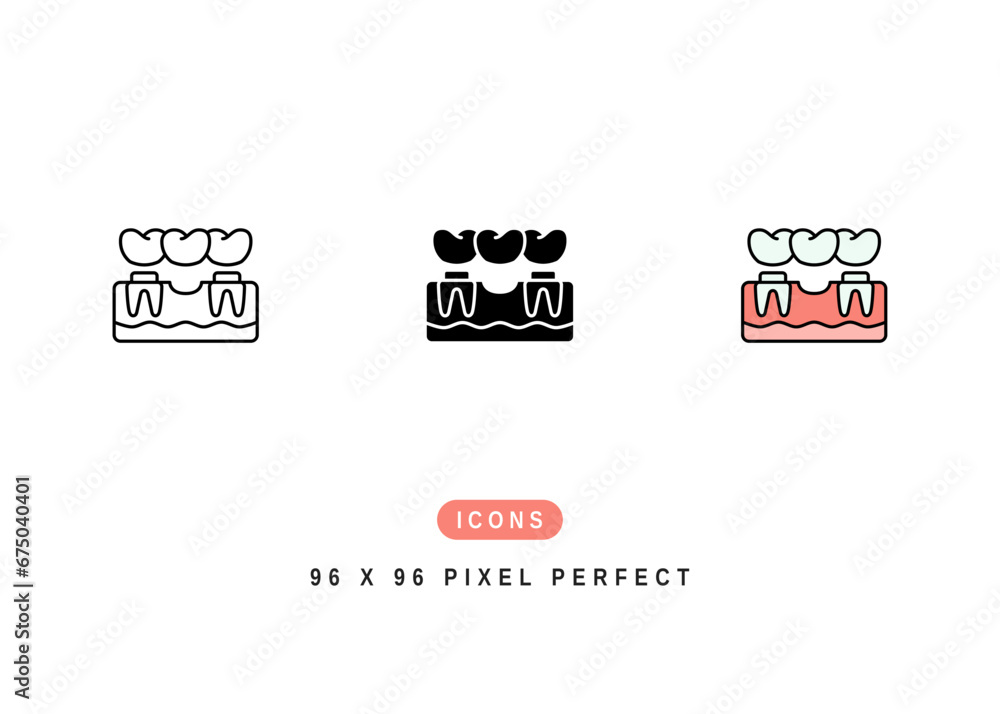 Dental Bridge Icon. Prosthesis Tooth Surgery Symbol Stock Illustration. Vector Line Icons For UI Web Design And Presentation