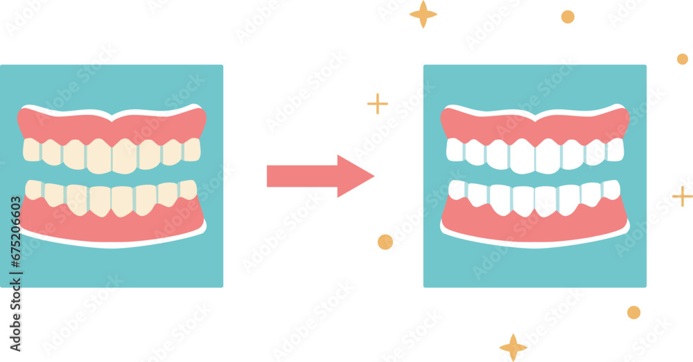 Teeth whitening, Dental care concept. Vector illustration in flat style. Dental hygiene.
