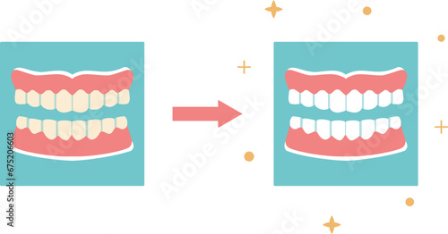 Teeth whitening, Dental care concept. Vector illustration in flat style. Dental hygiene. 