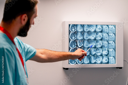 The radiologist carefully studies the MRI image on a special board describes what he saw and writes diagnosis conclusion photo