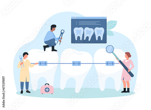 Teeth correction with braces, orthodontics and stomatology vector illustration. Cartoon tiny people with magnifying glass and dental equipment check human tooth with metal brace retainer on wire photo