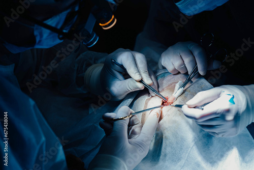 Obraz na plátně surgery with microscope glasses, neurosurgery.