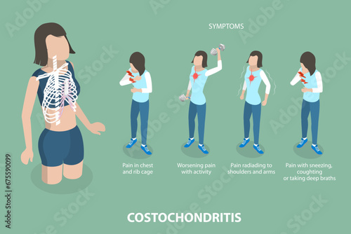 3D Isometric Flat Vector Illustration of Costochondritis, Chest Pain in the Upper and Middle Rib Cage