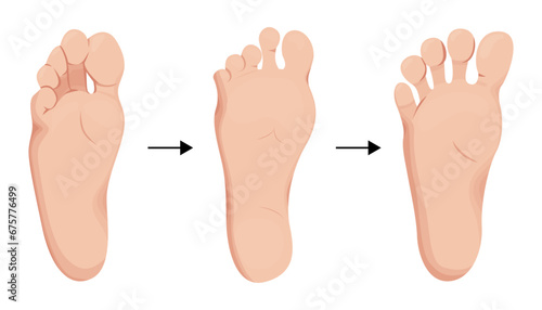Barefoot shoes care steps vector illustration.