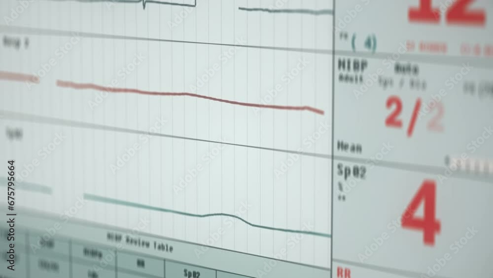 Monitoring the vital signs of an emergency patient in the hospital. Vital signs monitor indicating the survival of the sick person. Vital signs monitor showing the rise of a clinic patient heartbeat. Monitoring the vital signs of an emergency patient in the hospital. Vital signs monitor indicating the survival of the sick person. Vital signs monitor showing the rise of a clinic patient heartbeat.