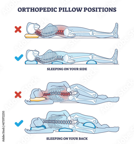 Orthopedic pillow positions with sleeping on side and back outline diagram. Labeled educational poses with good, correct and healthy example comparison to wrong vector illustration. Curved backbone. photo
