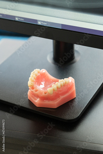 Dentures on a dentist's office table next to a computer screen (ID: 676144673)