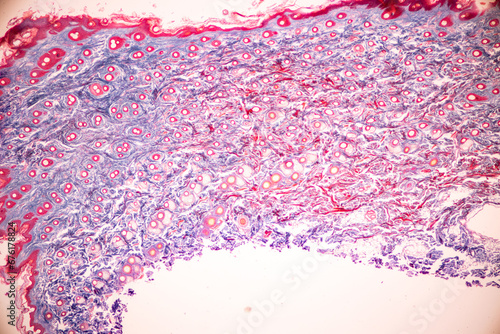 Characteristics Tissue of Human scalp, Skin human from general body surface and showing sweat glands under microscope. photo