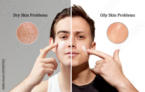 Dry skin vs oily ski problems. Young men with different skin types using cream for nutrition, moisturizing and healthy looking face. Concept of skincare, natural beauty, cosmetology, cosmetics, ad photo