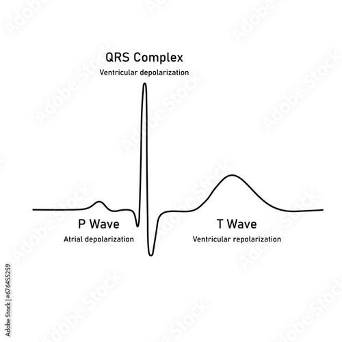 Ventricular repolarization, T wave. The QT interval of ECG. The cardiac cycle. ECG of a heart in normal sinus rhythm. Resources for teachers and students.