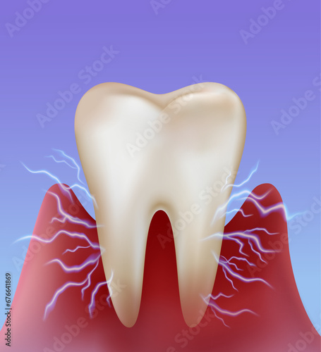 Tooth sensitivity from plaque Inflammation occurs at the root of the tooth, like an electric spark causing acute pain in the tooth. Dental treatment and prevention. Realistic vector illustration file.