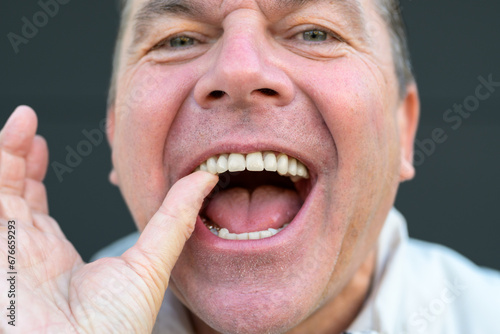 Extreme close-up of a man holding his Dental prosthesis with his thumb
