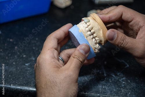 Dental gypsum models in dental laboratory with single tooth crown to be tested for Teeth occlude correctly photo
