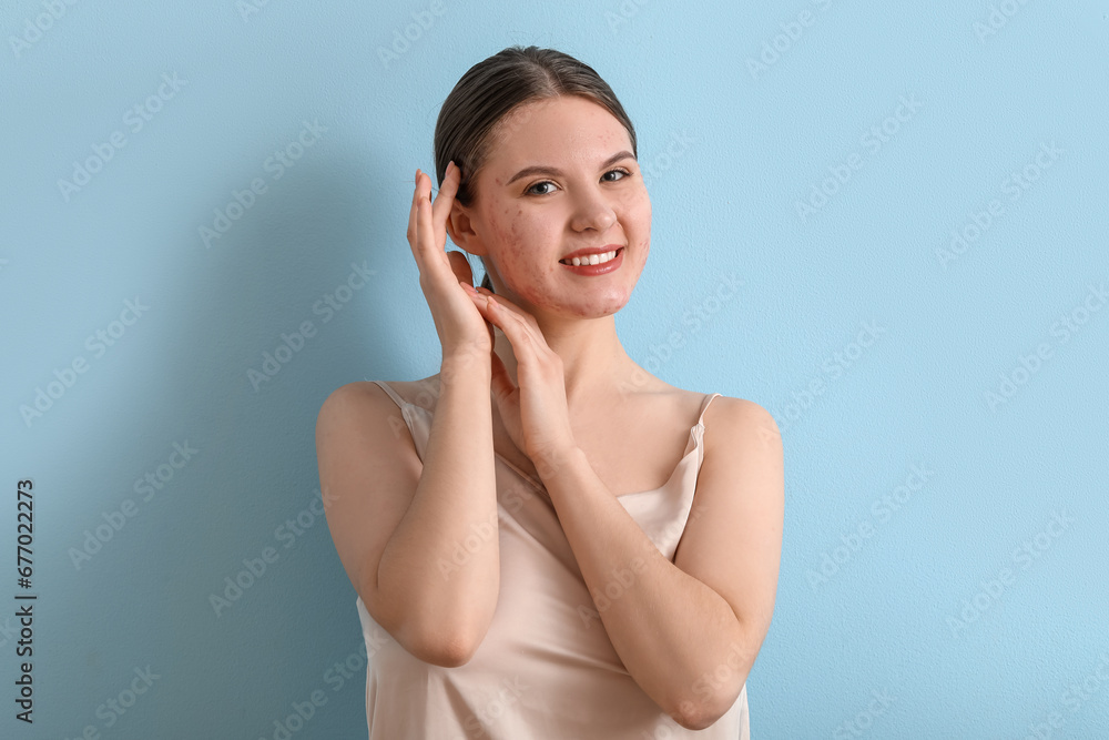 Young woman with acne problem on blue background Young woman with acne problem on blue background