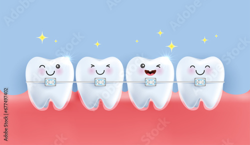Orthodontic dentistry. alignment of the bite of teeth, dentition with braces, dental braces. healthy lifestyle and dental care. medical apps, websites and hospital. vector.