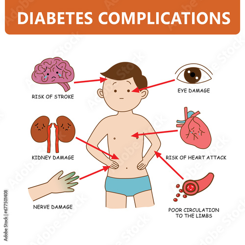 Diabetes complications with man symptom infographic cartoon illustration on white background