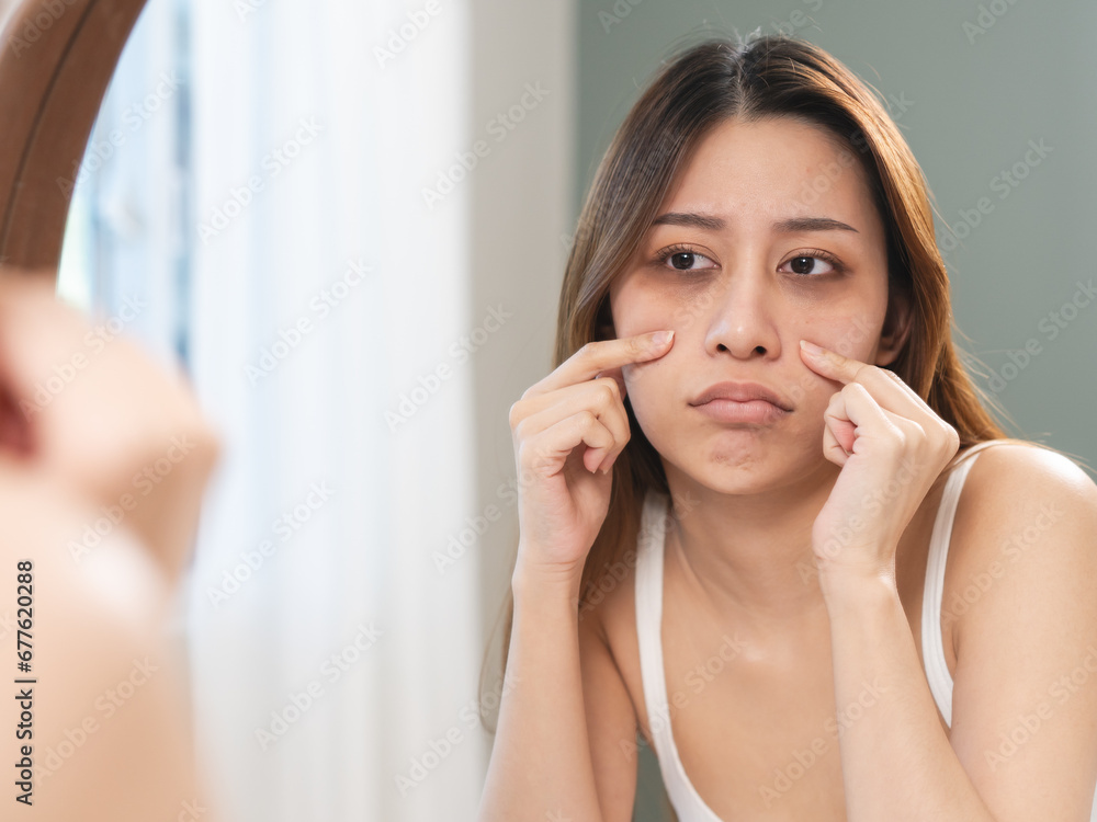 lack of sleep problem, Worried Asian young woman pointing finger at dark circles under her eyes lack of sleep problem, Worried Asian young woman pointing finger at dark circles under her eyes