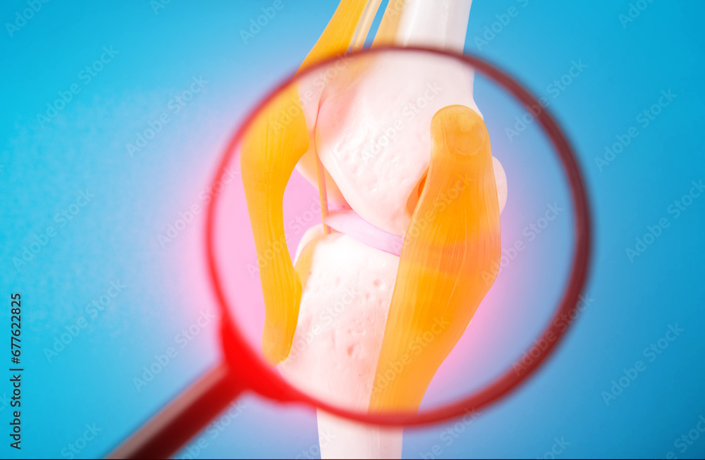 Medical mockup of a knee joint on a blue background under a magnifying