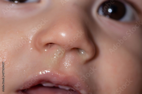 Fotografija Yellow snot from a child s nose, close-up