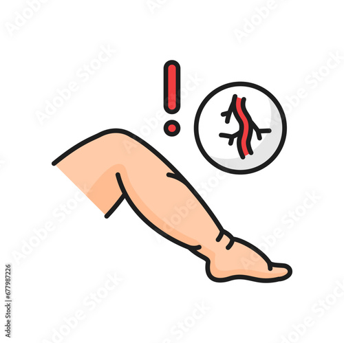 Venous disease edema color line line icon. Vector varicose vein and attention sign. Vascular mesh on legs. Venous edema, hypoproteinemia treatment disease