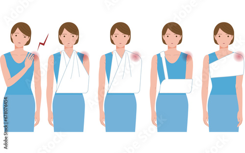 凍結肩,四十肩,五十肩,関節周囲炎で肩が痛み三角布等で腕を吊る女性