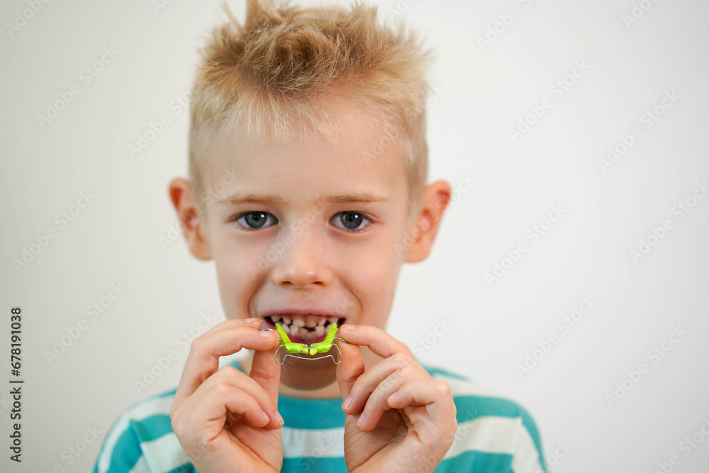 A blond-haired boy inserts orthodontic plate into his mouth to expand jaw and teeth. Close-up. Children's orthodontics, dental treatment, dentistry concept A blond-haired boy inserts orthodontic plate into his mouth to expand jaw and teeth. Close-up. Children's orthodontics, dental treatment, dentistry concept