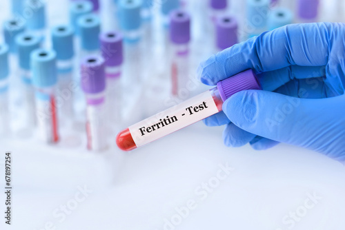 Doctor holding a test blood sample tube with ferritin test on the background of medical test tubes with analyzes photo