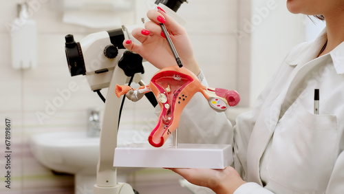 A gynecologist explains female diseases to a patient using a plastic model of the uterus and ovaries in a modern gynecological clinic. Prevention, preparation for medical examination, pregnancy.