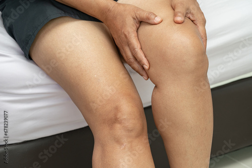 Asian lady woman patient touch and feel pain her knee  healthy medical concept.