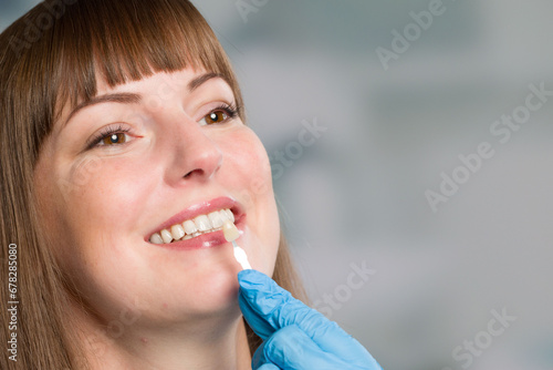 Close-up of dentist using shade guide at woman's mouth to check veneer of teeth for bleaching