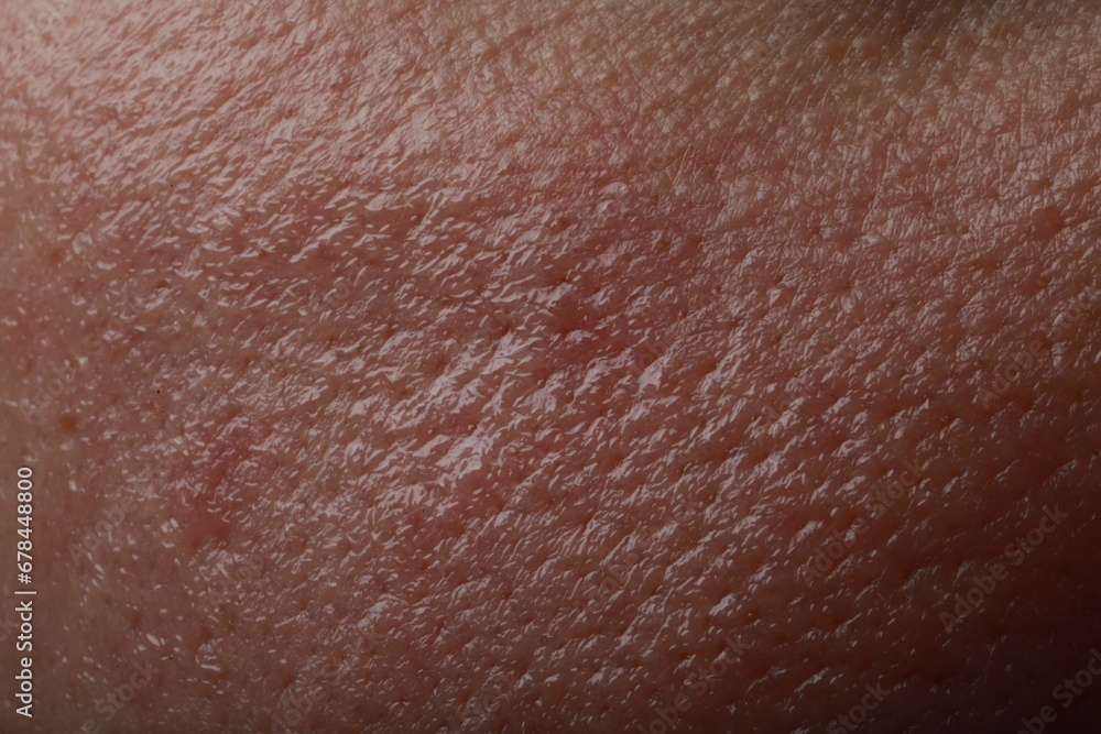 Fototapeta premium Closeup view of human oily skin as background
