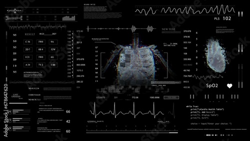 MRI x ray Scan, 3D Model.Medical monitor.HUD.Heads up display.Heart rate monitor. Analyzing cardiac diagnosis. Futuristic Technological Interface. Healthcare.Black background.3