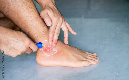 Man's hand is applying painkiller to his ankle due to pain, ankle inflammation, sprained ankle, irregular gait, health problems from being overweight. photo