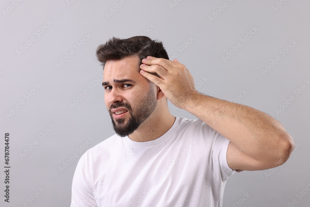 Emotional man with dandruff in his dark hair on light grey background Emotional man with dandruff in his dark hair on light grey background
