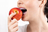Close up of young Caucasian smiling woman with braces biting off red apple. White background. Concept of orthodontic treatment and correction of malocclusion