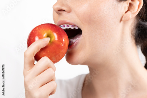 Close up of young Caucasian smiling woman with braces biting off red apple. White background. Concept of orthodontic treatment and correction of malocclusion