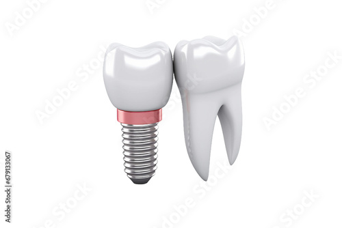 Dental Implant Grace Isolated on transparent background