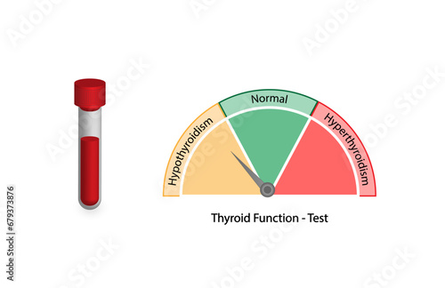 Thyroid function test, Thyroid gland. Hypothyroidism and hyperthyroidism. TSH, T3, T4 hormones. Thyroglobulin, Thyroid peroxidase and Thyroid stimulating hormone receptor antibodies. Vector design. photo