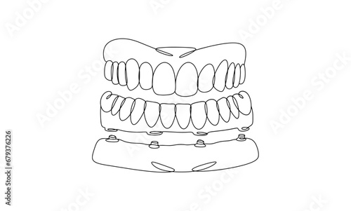 Denture. Lower jaw. One line