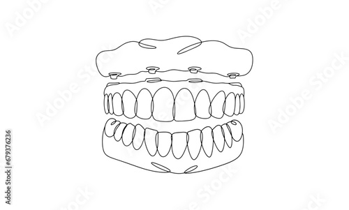 Denture. Upper jaw. One line