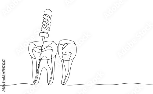 Pulpoextractor. Teeth. One line