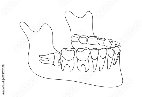 Lower jaw. Wisdom tooth. Teeth. One line