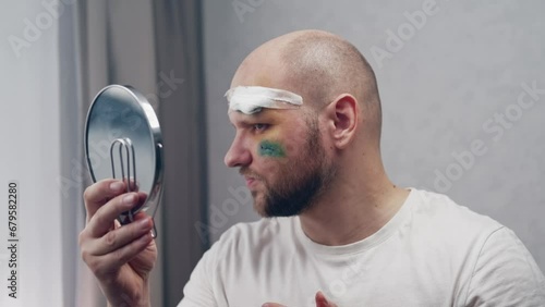 A wounded man with a stitched incision and a medical bandage on his forehead looks at his disfigured face in the mirror photo